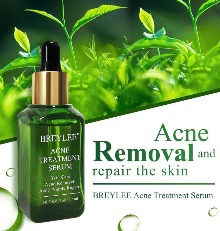 Acne Treatment Serum Facial Repair Oil Acne Treatment Serum Facial Repair Oil